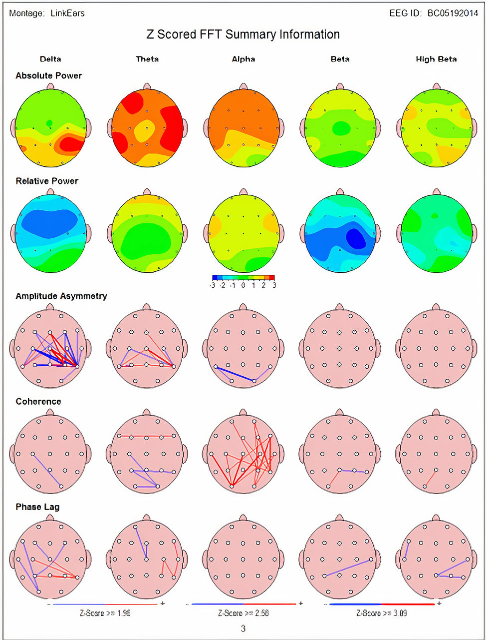 qEEG of patient with multiple concussions, ADHD, and behavioral problems