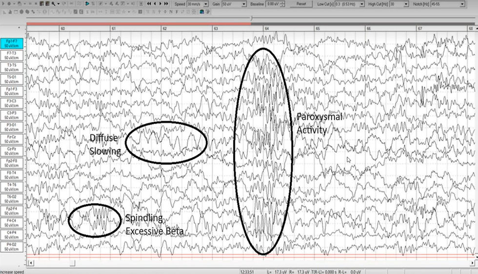 Diffuse slowing