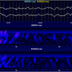 EEG