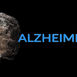 Alzheimer's