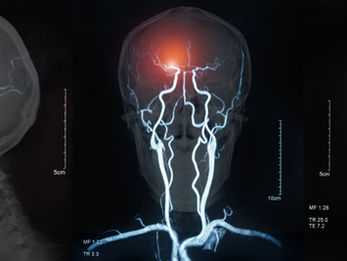 MRI