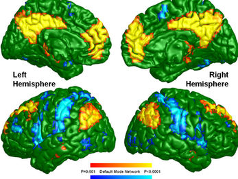 default mode network