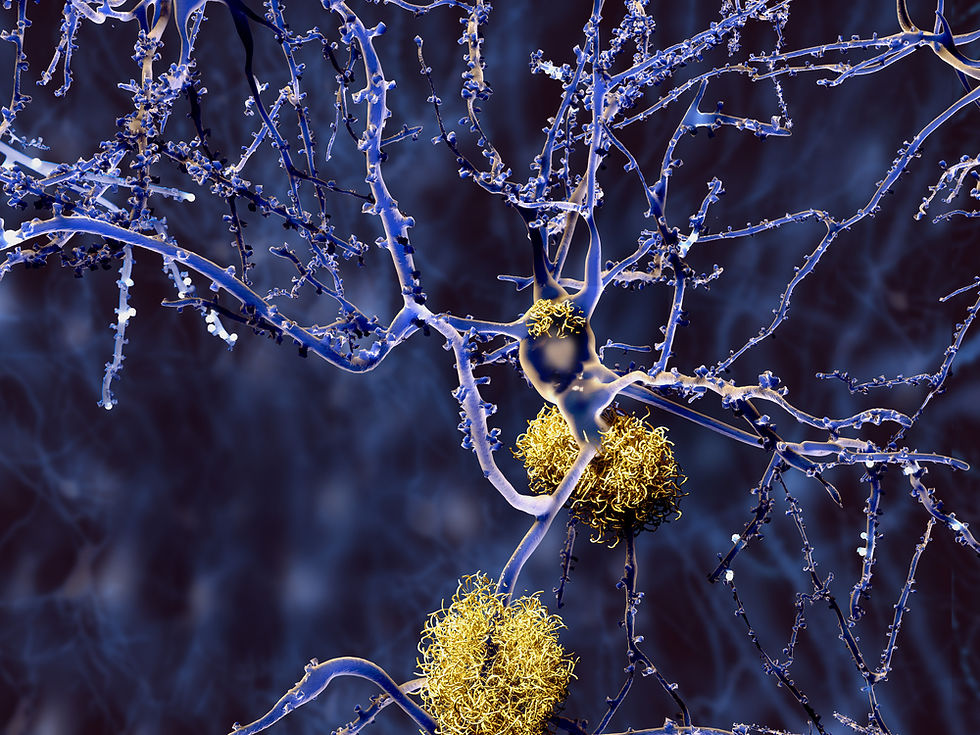 beta-amyloid