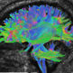 diffusion MRI