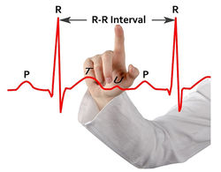R-R interval Arka