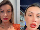 Procedimento nos olhos deixa Andressa Urach com dor intensa e alerta para riscos