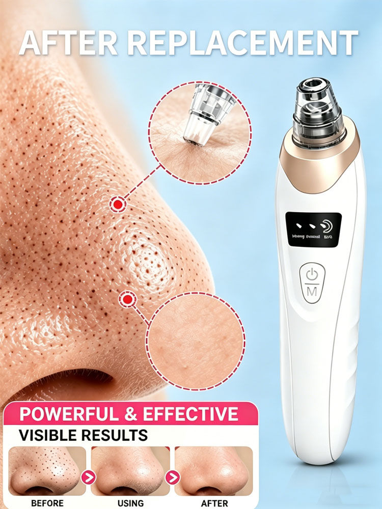 Professional Blackhead Vacuum - Rechargeable Pore Extractor for Blackheads, Oily