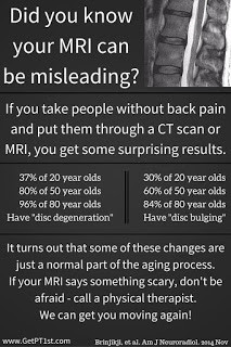 MRI Scans