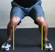 knee in