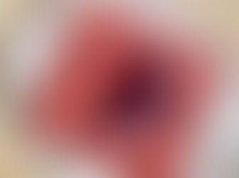 Excision of Arteriovenous malformation