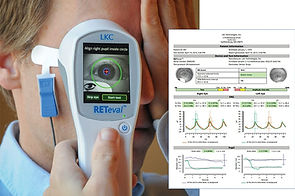 photo of the ret eval erg and a sample report