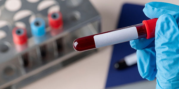 Blood Draw - Mobile Blood Work.jpg