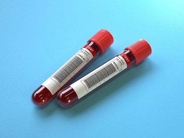 Blood Draw - Mobile Phlebotomy.jpeg