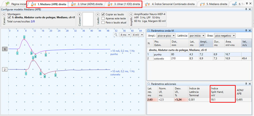 Índice Split Hand no teste de condução motora do nervo Mediano com captação no APB