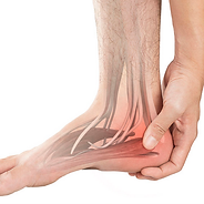 coalizão tarsal.png