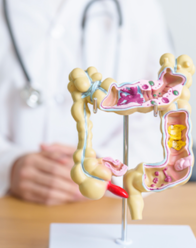 Anatomy: Large Intestine