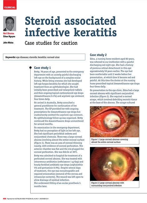 Steroid associated infective keratitis Australian Family Physican 2011.jpg