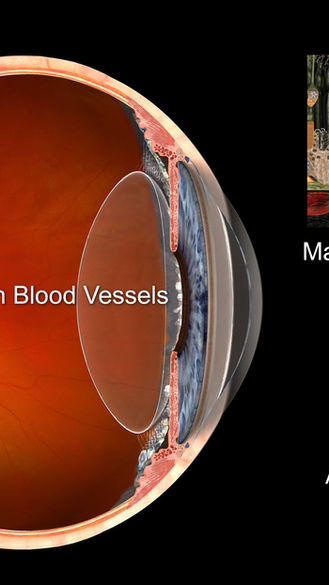New anti-VEGF intravitreal injection now available