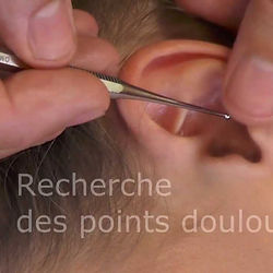 Stylet auriculothérapie (réflexologie des oreilles)