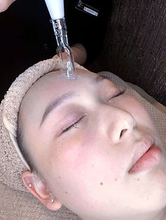Woman receiving Nova Plasma Facial on forehead with visible plasma current at the tip of the device during treatment at Beaut