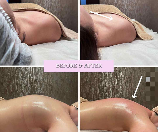 shoulder-and-back-relaxed-after-Bojin