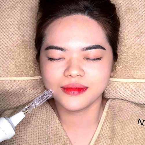 nova plasma facial treatment singapore with visible plasma energy skin rejuvenation