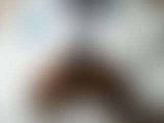 3 Ways the Healthcare Industry Benefits from Equipment Financing