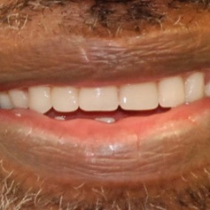 Smile made by Madison Pine Dental Clinic
