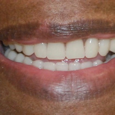 Smile made by Madison Pine Dental Clinic