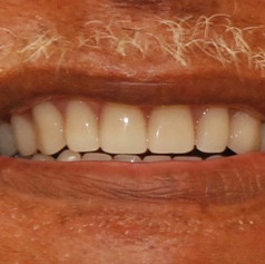 Smile made by Madison Pine Dental Clinic