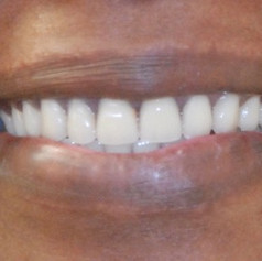 Smile made by Madison Pine Dental Clinic