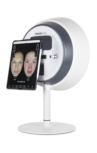 Observ huidscan