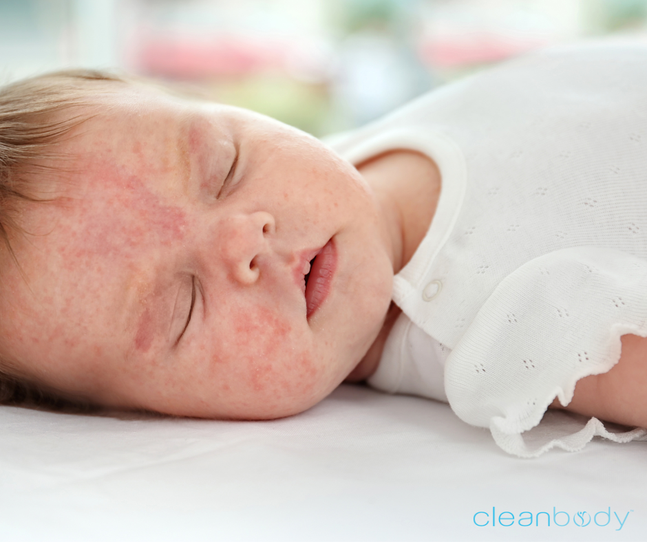 bpc 157 for eczema Eczema in Kids: 3 Hidden Root Causes Most Pediatricians Miss (and How to  Heal Naturally)