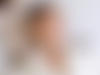 The Essential Guide to Dermal Fillers: Where to Begin Your Rejuvenation Journey 