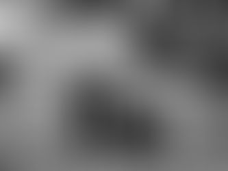 Växtbaserad kost och motion minskar symtom vid artros 