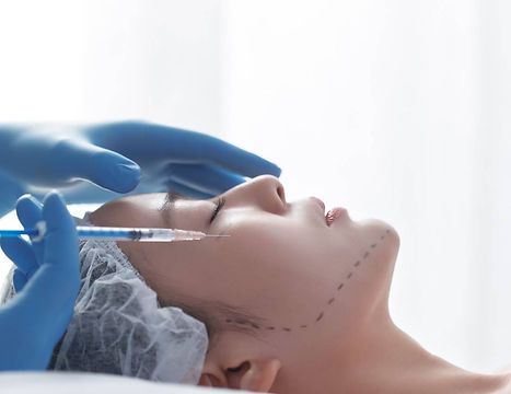 Microneedling Skin Booster