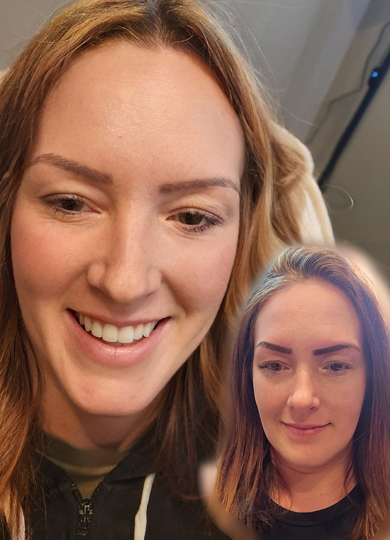 Dark or oversaturated eyebrows.png