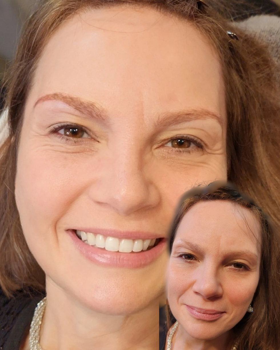 ScarCover-NanoBrows.png