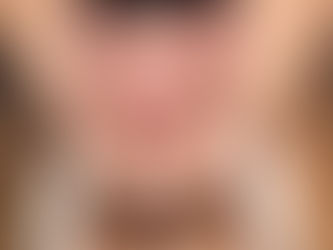 The Benefits of Tongue Scraping