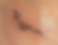 Close-up view of a faded and blurred tattoo on forearm