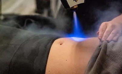 Localized Cryotherapy Sculpt