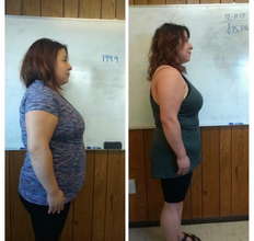Sculpt Body Contouring & Wellness Before and after results