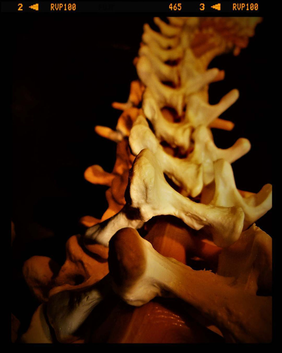 Wirbelsäule radiuszwei physiotherapie & pilates oberwil