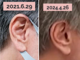 習近平說要扣好中美「第一顆鈕扣」。他的說話重複了許多次，就是聽不懂，抄筆記也沒有用！