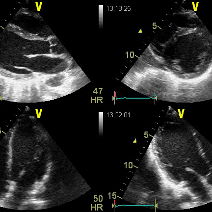 51026069_2162893160440533_23389615621626