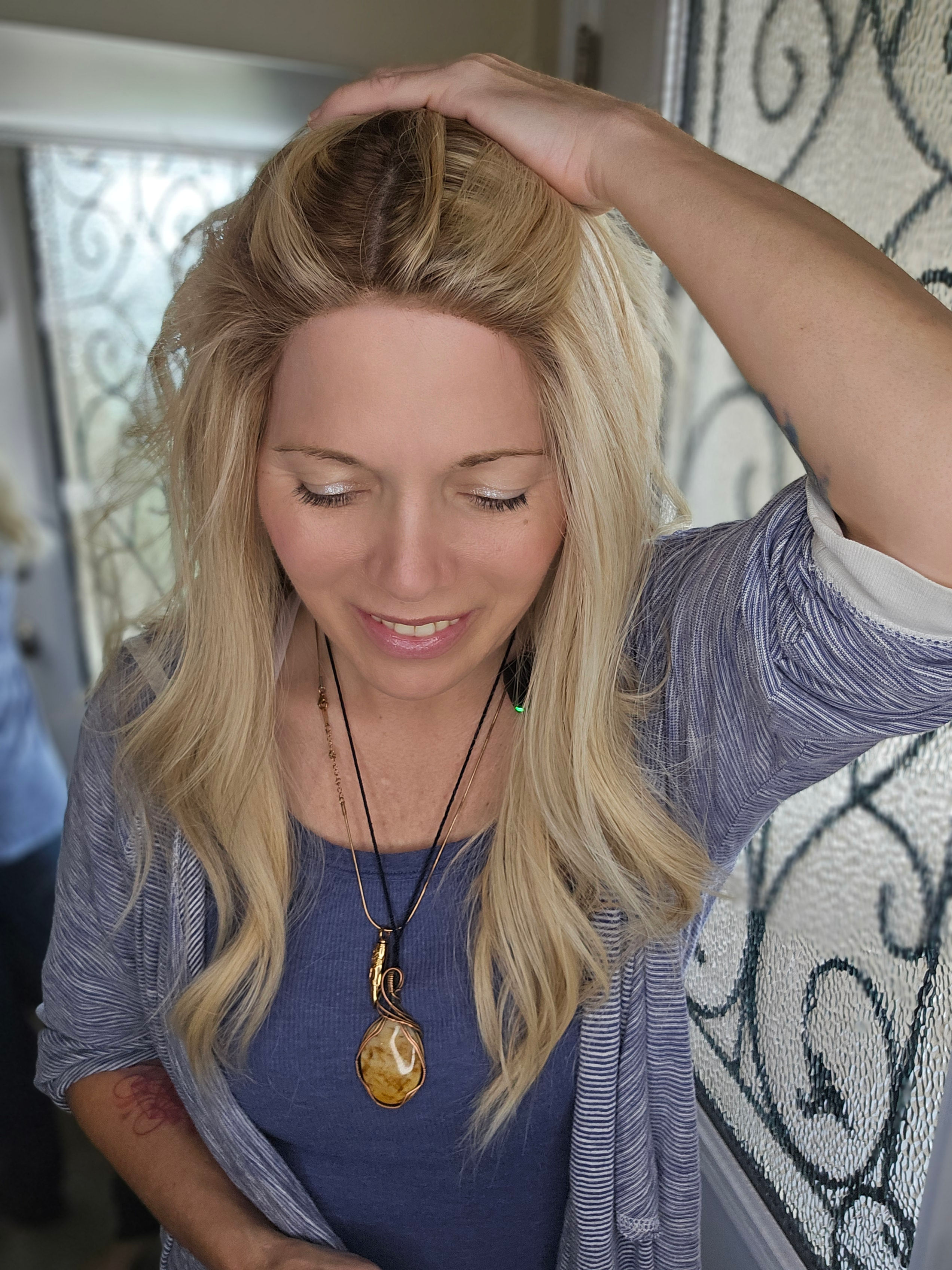 Wig Rehab Services For Grace (ventilation iWig)