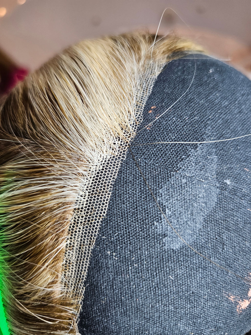 Thumbnail: Wig Rehab Services For Grace (ventilation iWig)