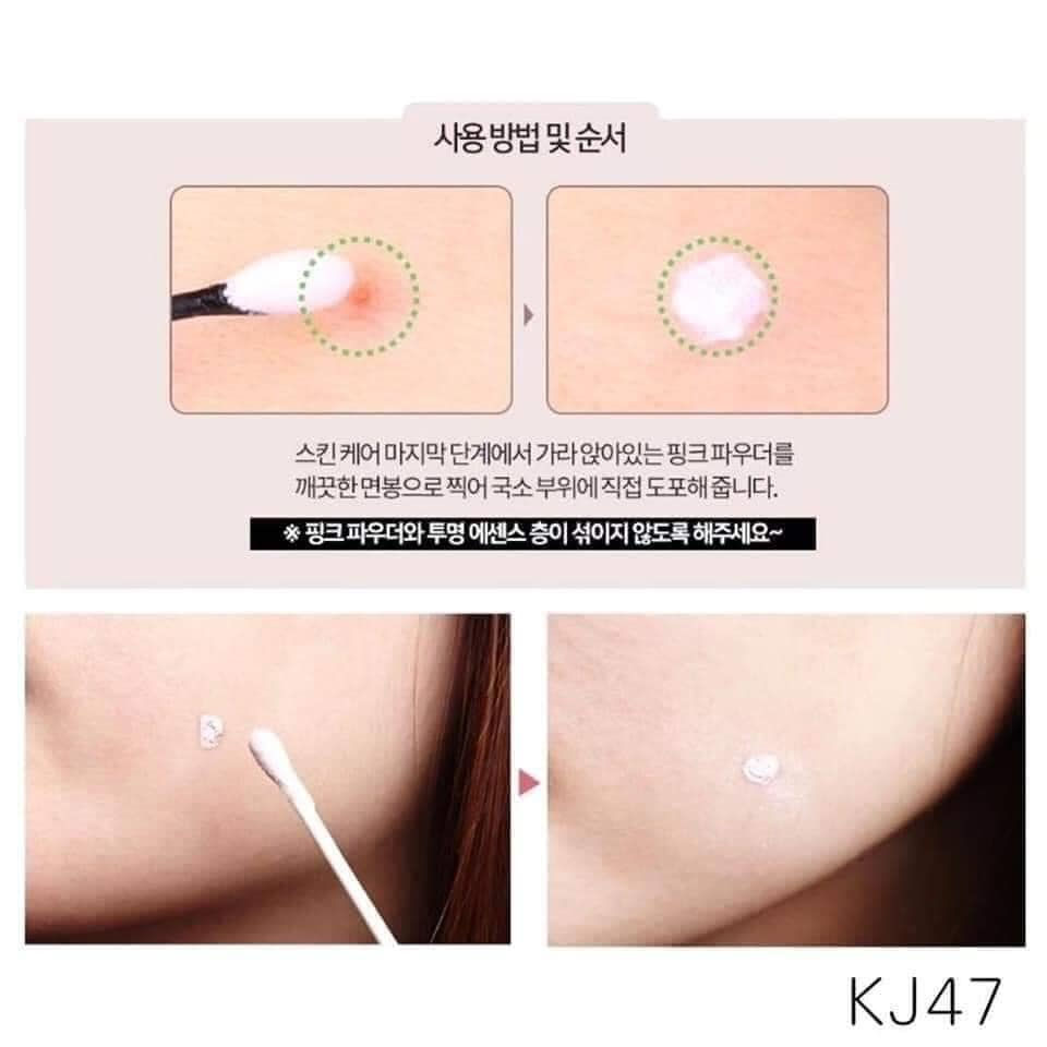 縮圖：The Yeon 痘痘液