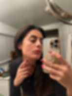 Skin Issues - Rosaura