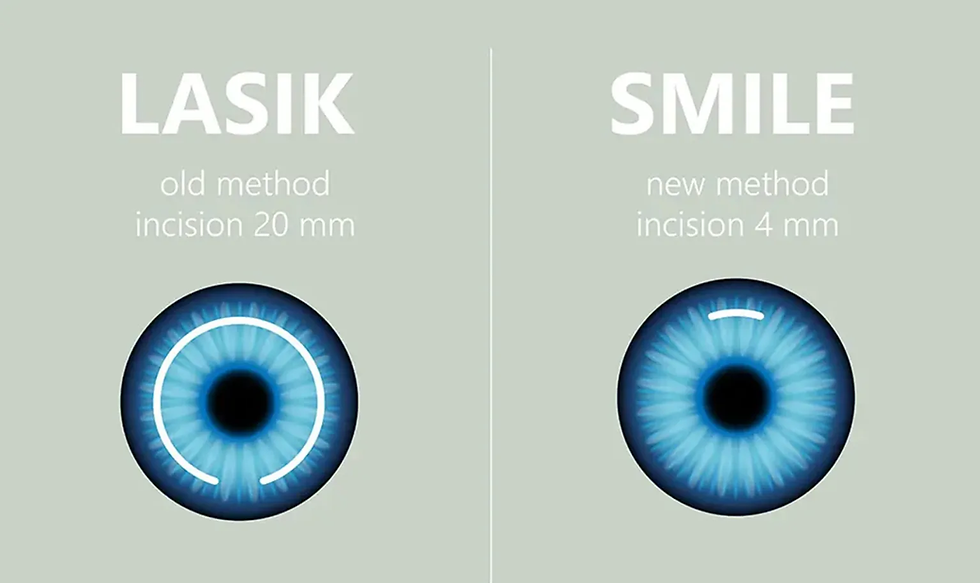 Lasik , Laser , eye,